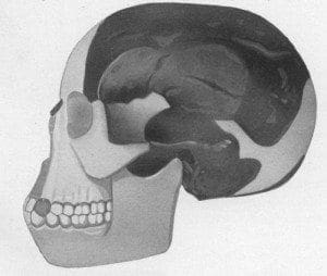 Hypothetical “Reconstruction” of Piltdown Man Skull