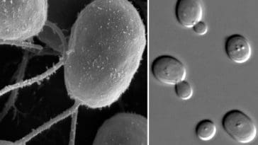 Electron microscope images of algae and yeast cells