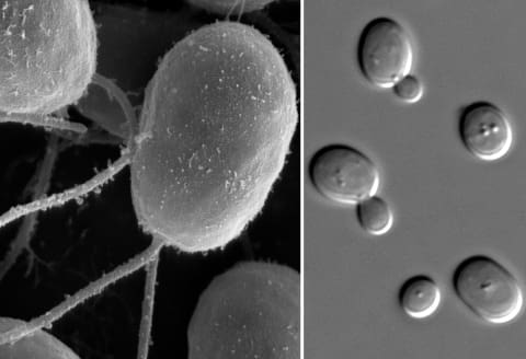 Electron microscope images of algae and yeast cells